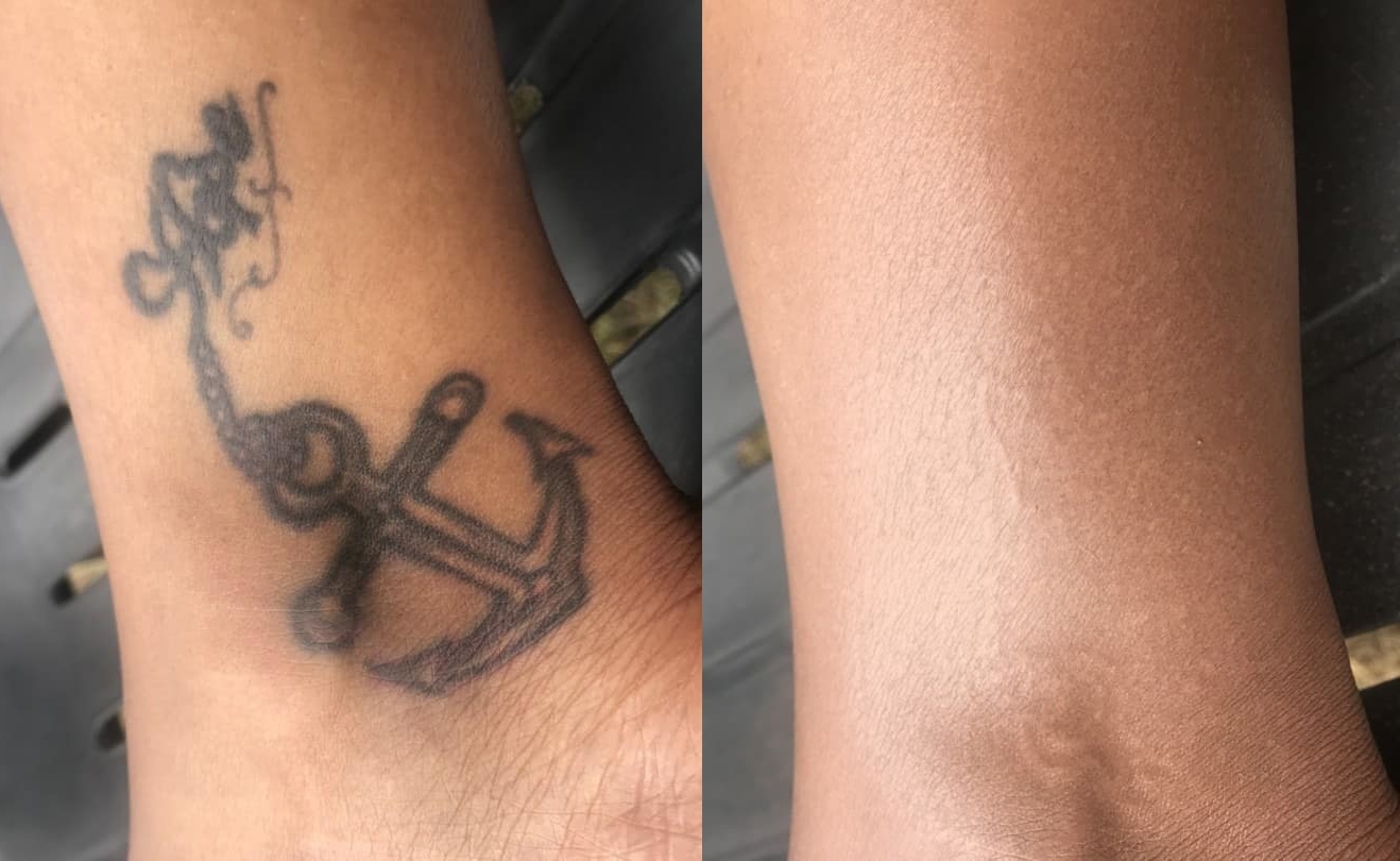 tattoo cover up